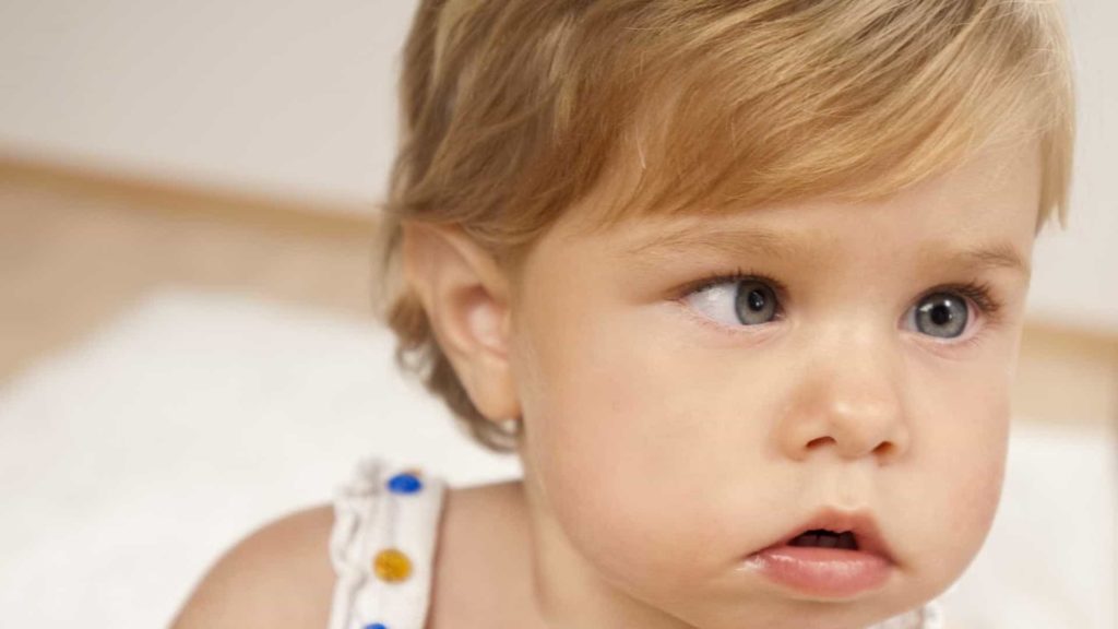Estrabismo infantil