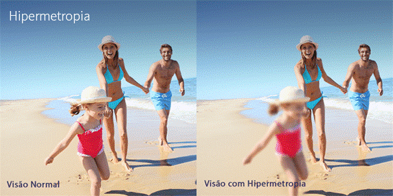 Quais são os sintomas da hipermetropia?