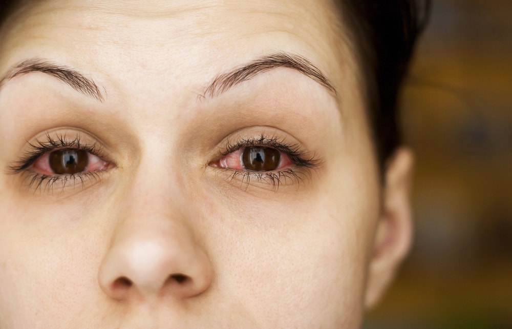 olhos secos sintomas