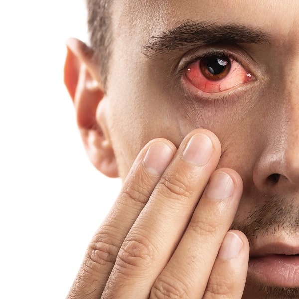 Trauma ocular
