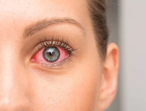 Saúde dos olhos: cuidados extras ao usar maquiagem com glitter