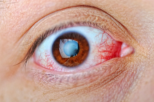 7 doenças mais comuns na retina